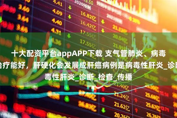 十大配资平台appAPP下载 支气管肺炎、病毒性肺炎输液治疗能好，肝硬化会发展成肝癌病例是病毒性肝炎_诊断_检查_传播